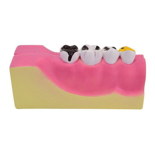 Model of Lower Jaw Segment