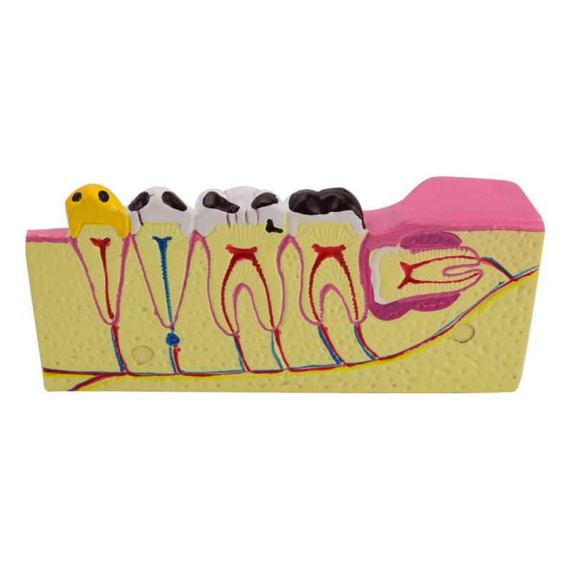 Model of Lower Jaw Segment