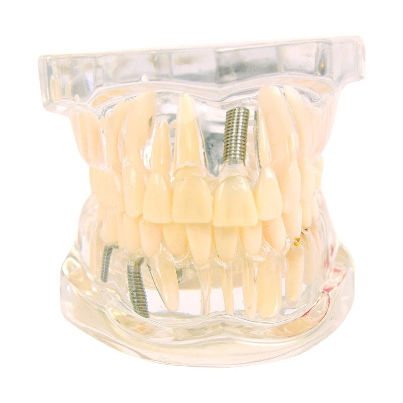 Detailed Jaw Model – Bozberg Dentist Supplies