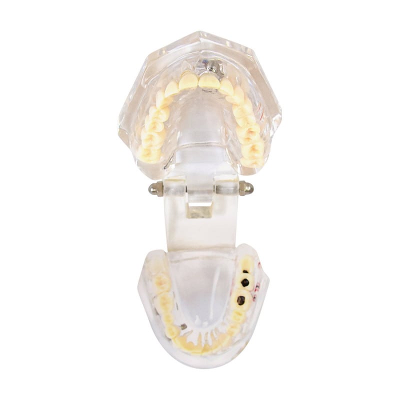 Detailed Jaw Model