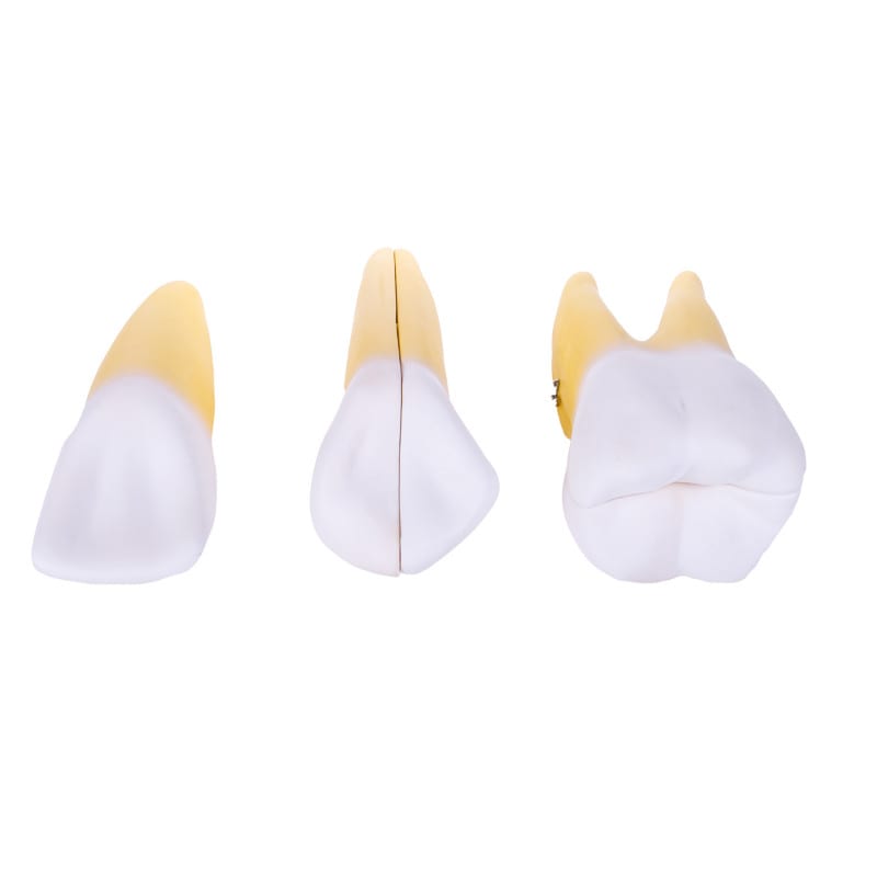 Dismountable Tooth Models, Set of 3