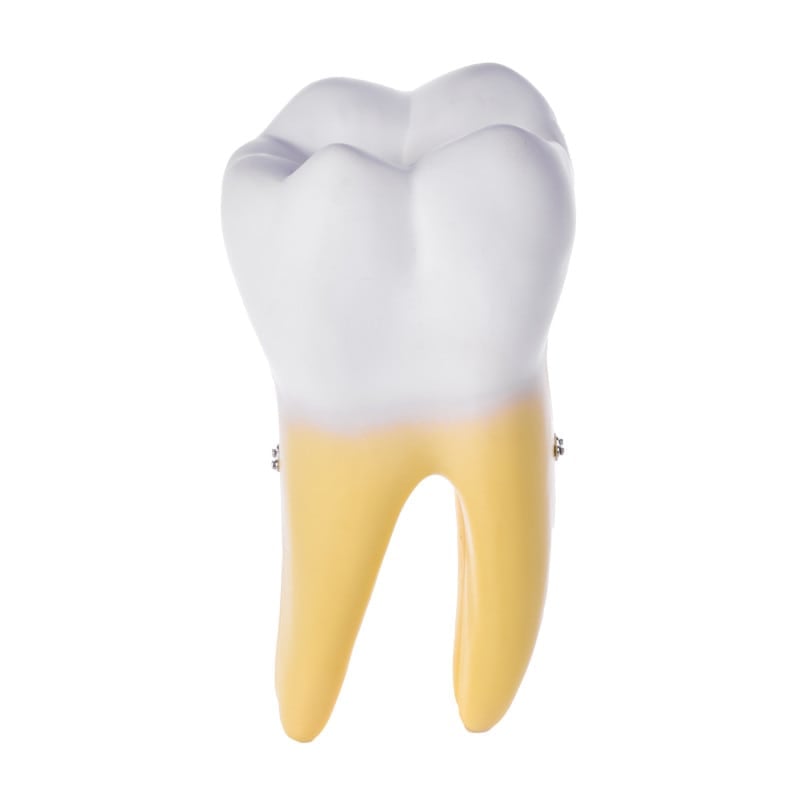 Dismountable Tooth Models, Set of 3