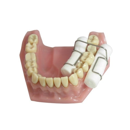 Dental Wad Holder, 4 pcs